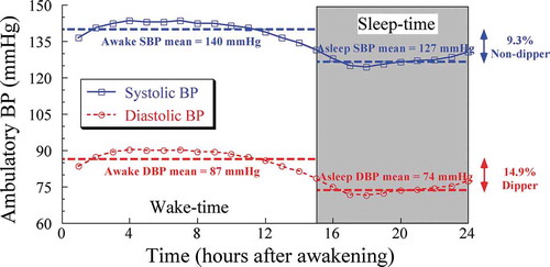Figure 7. Difference of ~4.4% in the calculated sleep-time relative decline for SBP versus DBP of the same arterial hypertensive individual assessed by around-the-clock ABPM, demonstrating the differential and misleading sleep-time relative decline dipping classification when improperly based on DBP measurements (resulting in conclusion of dipper categorization) rather than when properly based on SBP measurements (resulting in conclusion in nondipper categorization)