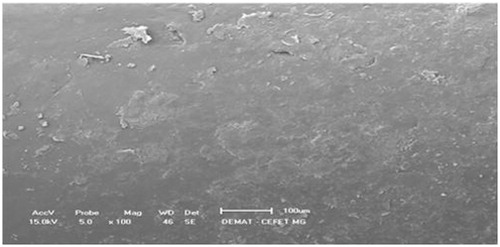 Figure 4. SEM of the internal surface of the MTX PCL implants -- x1000 magnification.