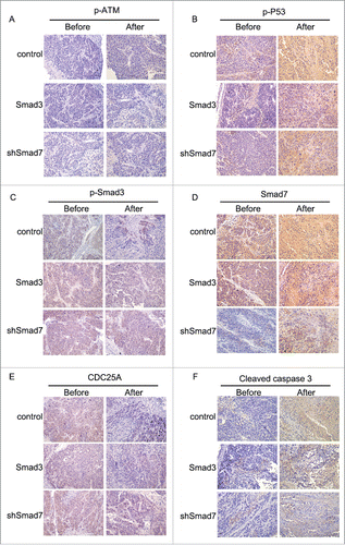 Figure 12. Immunohistochemical staining in evaluating the robustness of ATM pathway and Smad3/7 cascade before and after treated with radiation.