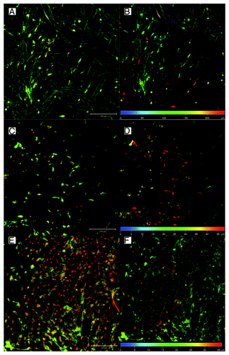 Figure 3. Confocal microscopy of MSCs seeded on fibers scaffolds prepared by Forcespinning®. Cells were stained with DiOC6 (green color) and propidium iodide (red color)—left column. Depth color projection was used to visualize distribution of the cells in scaffolds (right column). Cells penetrated to the depth more than 200 µm in scaffold Sample 1 (50% PCL, G20 orifice) (A and B) In the case of Sample 2—50% PCL, G30 orifice, classic deposition (C and D); and Sample 3—50% PCL, G30 orifice, CVD (E and F) the penetration was considerably smaller. The micrograph shows in figures A, C, and E mesenchymal stem cells stained with DiOC6 for membranes (green) and propidium iodide for nuclei (red). Figures B, D, and F represent color-coded depth profile of cells on scaffolds.