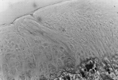 Figure 2. Osteochondral defect at 24 weeks after laser treatment (safranin-0 and picrosirius red). Magnification: ×20. Cartilaginous cells appear arranged in a palisade structure; matrix staining of the reconstituted cartilage is more intense for both proteoglycans and collagen in the deepest layers.