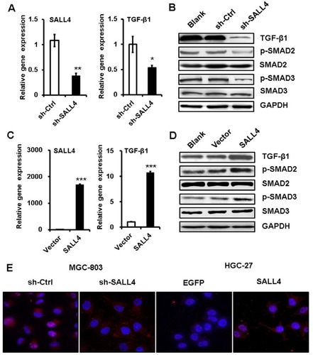 Figure 4 SALL4 regulates the activation of TGF-β/SMAD signaling pathway.Notes: (A) qRT-PCR analyses of SALL4 and TGF-β1 expression in SALL4-depleted MGC-803 cells. (B) Western blot assays for the expression of phosphorylated SMA2/3 in SALL4-depleted MGC-803 cells. (C) qRT-PCR analyses of SALL4 and TGF-β1 expression in SALL4-overexpressing HGC-27 cells. (D) Western blot assays for the expression of phosphorylated SMA2/3 in SALL4-overexpressing HGC-27 cells. (E) Immunofluorescent staining of p-SMAD3 in SALL4-depleted MGC-803 cells and SALL4-overexpressing HGC-27 cells. *P<0.05, **P<0.01, ***P<0.001.Abbreviation: qRT-PCR, quantitative real-time PCR.