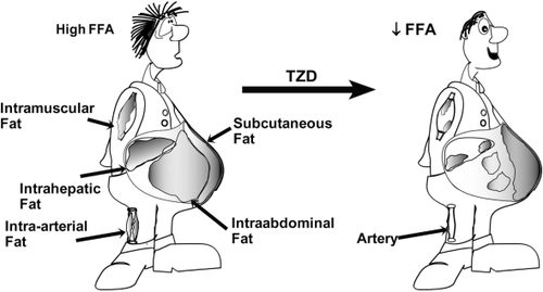 Figure 5 Effect of thiazolidinediones (TZDs) on body fat distribution.