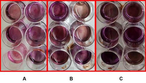 Figure 13 Results of ARS staining of (A) control group, (B) group Z, (C) group ZH (n = 9).