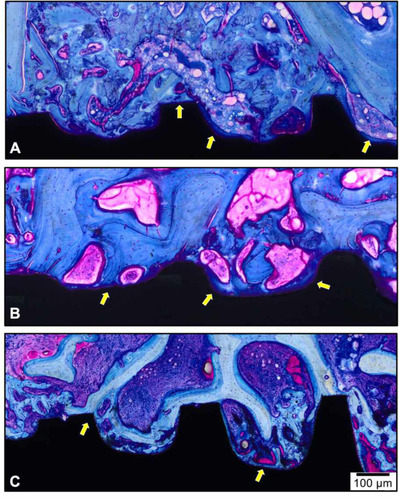 Figure 7 Representative photomicrographs of wound healing to different implant surfaces 28 days after implantation. (A) HAnano®, (B) SLActive® and (C) TiUnite®. Observe the three most coronally situated implant’s threads that were located in the cancellous bone. The yellow arrows represent regions of bone-implant contact. Stain: Toluidine Blue and Acid Fuchsin. Magnification: 20×; Scale bar: 100µm.