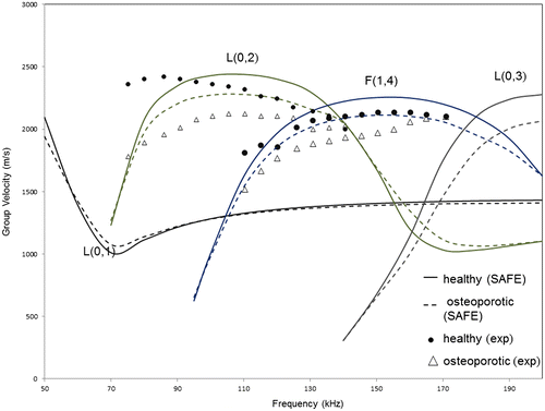 Figure 4. Group velocity dispersion curves (for longitudinal modes) from SAFE analysis (solid – healthy cortex filled with marrow, dashed – osteoporotic cortex filled with marrow) and from experiments (marked) for model 1.