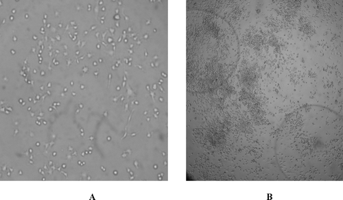 FIG. 6 Photomicrographs of RAW 264.7 control macrophage cells and experimental RAW 264.7 macrophage cells after exposure to APA encapsulated thalidomide formulations. (A) Photomicrograph of control macrophages (×200) (B) Experimental: photomicrograph of macrophages after 48 hr exposure to APA microcapsules thalidomide exposers (×200). APA microcapsule thalidomide formulations also are seen in the photomicrograph.