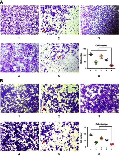 Figure 4 Functional miRNA liposomes inhibiting invasion and migration of TNBC cells. (A) The cell invasion of MDA-MB-231 cells after treatments. 1, blank control; 2, functional miRNA liposomes; 3, functional miRNA liposomes with TGF-β1/Smad inhibitor; 4, functional vinorelbine liposomes; 5, functional miRNA liposomes with functional vinorelbine; 6, counted invasion cell numbers of 9 visual fields, **P<0.01. The red arrows indicate the invading cells transfected with functional miRNA liposomes are significantly reduced compared with blank control group. The results demonstrate that both functional miRNA liposomes and functional vinorelbine liposomes enable to inhibit cell invasion, and the combination treatment using functional miRNA liposomes with functional vinorelbine liposomes exhibit the strongest inhibitory effect. (B) The cell migration of MDA-MB-231 cells after treatments. 1, blank control; 2, functional miRNA liposomes; 3, functional miRNA liposomes with TGF-β1/Smad inhibitor; 4, functional vinorelbine liposomes; 5, functional miRNA liposomes with functional vinorelbine; 6, counted migration cell numbers of 9 visual fields, **P<0.01. The red arrows indicate the migrating cells transfected with functional miRNA liposomes are significantly reduced compared with blank control group. The results demonstrate that both functional miRNA liposomes and functional vinorelbine liposomes enable to inhibit cell migration, and the combination treatment using functional miRNA liposomes with functional vinorelbine liposomes exhibit the strongest inhibitory effect.