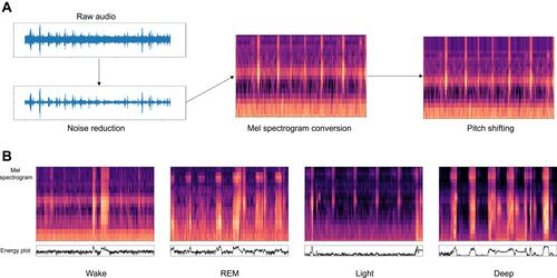 Figure 2 (A) Entire preprocessing procedure. For noise suppression, adaptive spectral gating was applied to each 30-second window to suppress stationary noise profile. Pitch shifting simulated different types of respiratory events, different individual’s characteristics of respiratory sound, and different frequency responses of the microphone. (B) Mel spectrograms and corresponding audio energy plots in dB scale for each sleep stage. Mel spectrograms emphasize the pattern which is more stable and independent from overall energy level (sound amplitude).