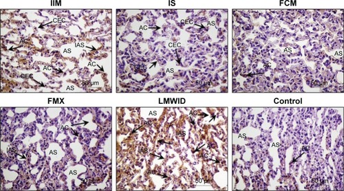 Figure 3 HIF-1α immunohistochemistry.