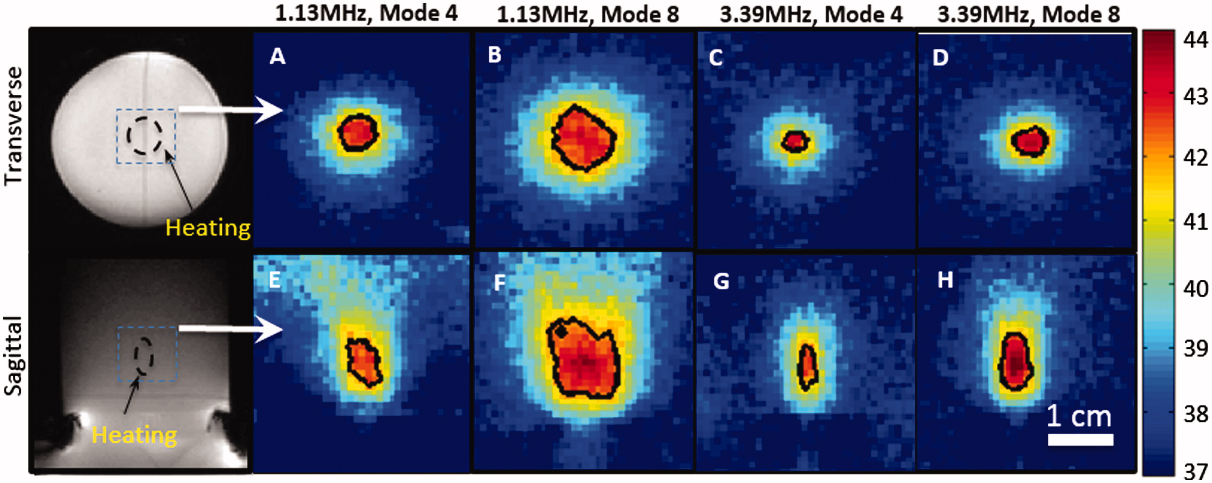 Figure 4. Normalised contour plots of the spatial intensity distribution along the ultrasound beam axis at three different frequencies, using a mode 4 lens.