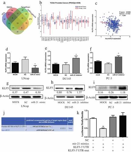 Figure 4. MiR-21 directly targets KLF5 in PCa.