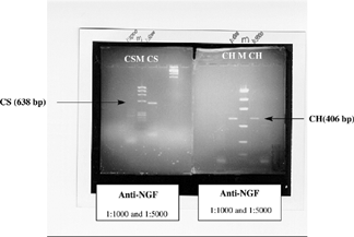 Figure 2 Image of the gel with gene products for cathepsin S (CS) and cathepsin H (CH) obtained by RT-PCR from 14-day embryonic kidneys cultured in vitro for two days under normal conditions with anti-NGF (1:1000 and 1:5000) treatment. The “M” line refers to the digested plasmid used as a marker.