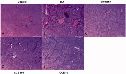 Figure 5. Haematoxylin and eosin (H&E) stain of liver tissues. At the end of the experiment, all of the animals were sacrificed and livers were fixed in Bouin’s solution. After staining with H&E, liver sections were taken under light microscopy. Control (A), TAA (200 mg/kg): TAA-induced liver fibrosis rats (B), silymarin (50 mg/kg): positive control rats (C), CCE 100: CCE 100 mg/kg treated rats (D), CCE 10: CCE 10 mg/kg treated rats (E). Scale bar =200 μM.