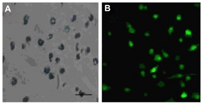 Figure 1 Morphology of dendritic cells labeled with 25 μg/mL superparamagnetic iron oxide particles after 12 hours incubation. (A) Labeled dendritic cells (Prussian blue staining, 400×) and (B) green fluorescence of enhanced green fluorescent protein transgenic dendritic cells (400×).