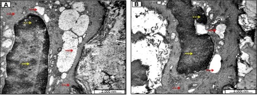 Figure 18 Ultrastructural electron micrographs of aortic tunica media myofibrils.
