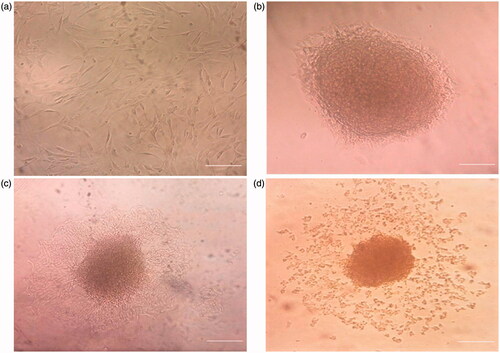 Figure 1. Morphologic changes in the cells on TCPS at different time periods of differentiation. (a) Day 0, the cells were spindle shaped before induction (original magnification 100×); (b) Day 1, the induced cells turned shorter and changed into round cells and islet-like cell (ILC) clusters appeared (original magnification 100×); and (c) Day 6, the center of large cell cluster was dense and its peripheral migrated to outer part of cluster; (d) large ILC separated to small cell clusters. Scale bar 100 uM.