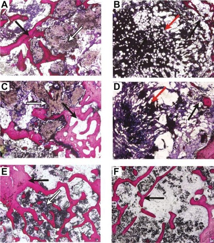 Figure 10 Van Gieson stained sections of n-CDHA/MAC/CSH cement (A, C and E) and CSH cement (B, D and F) harvested at 4 (A and B), 8 (C and D), and 16 (E and F) weeks post-implantation (magnification 40×).Notes: Black arrows denote newly formed bone tissue, white arrows denote n-CDHA/MAC/CSH cement, and red arrows denote CSH cement.Abbreviations: CSH, calcium sulfate hemihydrate; n-CDHA/MAC, nano calcium-deficient hydroxyapatite/multi(amino acid) copolymer.