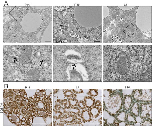 Figure 3. Transition from gestation to lactation in the mouse mammary gland. (A) Transmission electron microscopy (TEM) images of mouse mammary glands at pregnancy day 16 (P16), pregnancy day 18 (P18), and lactation day 1 (L1). Boxed regions are shown below at higher magnification. Scale bars: 1 μm. Three sections from three independent mice were evaluated by TEM. (B) Immunohistochemical staining for sequestosome 1 (SQSTM1) at P16, L1, and L10. Scale bars: 100 μm. Two mice were evaluated for each time point, and two sections from each mouse were stained for comparisons