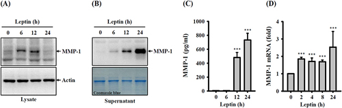 Figure 1 Effect of leptin on MMP-1 expression. (A–C) SV40 cells were exposed to 100 ng/mL of leptin for 6–24 hours. Subsequently, the MMP-1 protein expression in both cell lysates (A) and supernatants (B) was assessed through Western blotting. Additionally, (C) the MMP-1 protein expression in supernatants was quantified using ELISA. (D) In a separate experiment, SV40 cells were incubated with 100 ng/mL leptin for 2–24 hours, and the MMP-1 mRNA expression was determined via RT-real-time PCR. Data from the ELISA and RT-real-time PCR are presented as means ± SD from three distinct experiments. Images obtained from Western blotting are representative of individual experiments. The significance of the findings is denoted by ***p < 0.001 when compared to control cells.