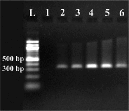 Figure 2. Gel picture of 322-bp amplified PCR products carried out under identical PCR conditions but with different amounts of microdissected tissue.Areas of microdissected tissue from lane 1 to 6 were 1715, 4200, 7874, 37,936, 50,361, and 38,865 µm2, respectively. A 100-bp DNA ladder (L; New England Biolabs, Ipswich, MA, USA) was used.