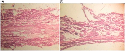 Figure 3. Skin histological micrographs (A) Control skin; (B) EGVs treated skin.