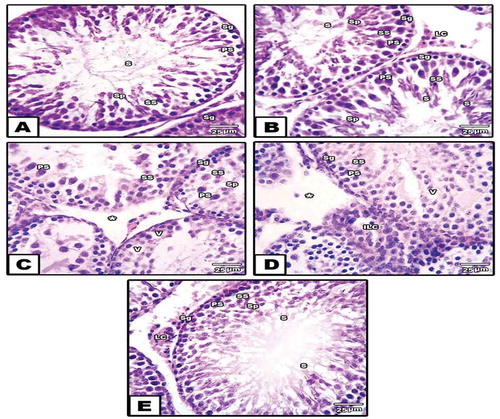 Figure 5. Photomicrograph of histological sections through the testes of control (a), neem (b), diabetes (c,d) and diabetes with neen (e) groups. In (a) and (b), the seminiferous tubules are showing the normal histological architecture. In (c) and (d), the seminiferous tubules are showing remarkable degeneration with obvious wide inter-tubular spaces, infiltrated Leydig cells, hemorrhage, separated basement membrane (star) and vacuoles. In (e), the seminiferous tubules are showing remarkable amelioration in their architecture (H&EX: 400)