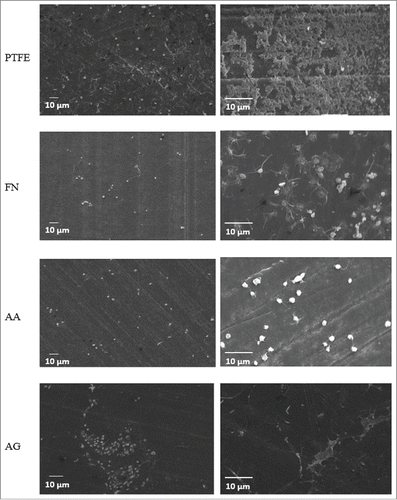 Figure 7. SEM images for platelets adhesion on the different coatings after 2 h of contact. Two different magnifications are shown for each surface. PTFE) Uncoated PTFE; FN) Fibronectin adsorption; AA) Fibronectin and phosphorylcholine adsorption; AG) Fibronectin adsorption-phosphorylcholine grafting.