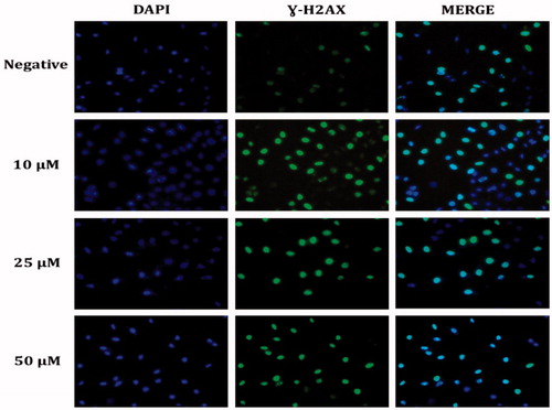 Figure 6. Representative DNA damage microscopy images from HeLa cell treated with sulphonamide 1. A fragment of each cell was fixed and processed for γ-H2AX immunofluorescent staining (IFA). γ-H2AX staining is green; nuclei are stained with DAPI blue.