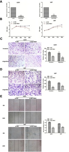 Figure 1 Knockdown of BCYRN1 inhibits the proliferation and metastasis of glioma. (A) Decreased BCYRN1 levels in U87 and U251 cells transfected with si-BCYRN1, using si-NC as a negative control. The data are presented as the mean±SD (n=3 in each group). ***p<0.001 vs the si-NC group. (B) BCYRN1 knockdown significantly inhibited the proliferative capability of U87 and U251 cells as determined by MTS assays (*p<0.05, **p<0.01, ***p<0.001). (C and D) Transwell assay results for U87 and U251 cells transfected with si-BCYRN1 and si-NC. Representative images and the accompanying statistical plots are presented. The data are presented as the mean±SD (n=3 in each group). *p<0.05, **p<0.01 vs the si-NC group. (E) The wound-healing assay showed the migratory abilities of U87 and U251 cells transfected with si-BCYRN1 and si-NC. Wound closure was measured at 0 h and 24 h. Representative images and the accompanying statistical plots are presented. The data are presented as the mean±SD (n=3 in each group). **p<0.01 vs the si-NC group.