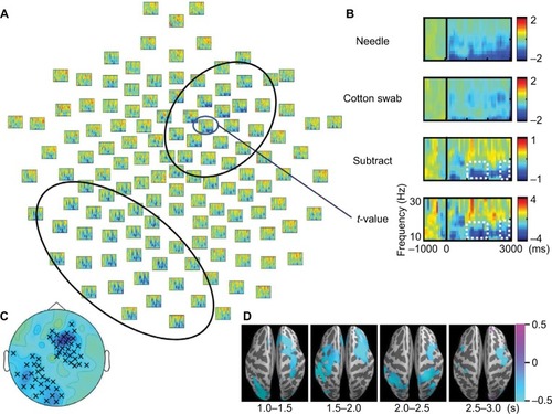 Figure 2 t-value maps (needle condition vs. cotton swab condition) of the 128-ch electroencephalography (EEG) system. (A) Two significant clusters of electrodes estimated based on t-values are outlined by black oval lines. Induced α/β band activity was decreased in the needle condition over the right frontocentral and left parietooccipital regions. (B) The top (Needle) and second (Cotton swab) rows show the logarithmic-transformed power value normalized to that of the prestimulus period for needle and cotton swab conditions. The third (Subtract) row represents the subtracted value of the cotton swab condition from that of the needle condition. The bottom (t-value) row shows the t-value map of the t-test that compares the two conditions. Positive values mean that the value of the needle condition is greater, whereas negative values mean the opposite. The power suppression of the needle condition was enhanced between 200 and 3000 ms after movie onset for 10–16 Hz (white dotted line). (C) Significant clusters during the 1500–2000 ms segment are indicated by a multiplication sign (×). Right frontocentral and left parietooccipital clusters were confirmed by a cluster-based permutation test. (D) Source estimation was conducted on the standard brain using the beamformer method to analyze magnetoencephalography data for the same time and frequency window shown in EEG. Blue color indicates suppression of power values by the needle condition. The data are masked by t-values corresponding to p<0.05. The areas of α/β band suppression were distributed over the frontal and parietal lobes, and the desynchronization of α/β over the frontal lobe was lateralized to the right hemisphere, similar to EEG.