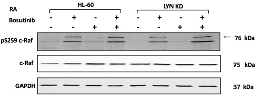 Figure 5. Regulation of pS259 Raf and Raf in HL-60 wt versus Lyn KD cells by RA and Bosutinib. HL-60 wt and Lyn KD cells were untreated Controls or treated with 1 µM RA, or 0.25 µM Bosutinib or 1 µM RA and 0.25 µM Bosutinib as indicated. Cells were cultured for 72 h, and the whole cell lysate was collected. Twenty-five microgram of lysate per lane was used. Western blots of SDS PAGE-resolved lysates were probed for pS259 c-Raf and c-Raf, (n = 3 biological repeats). GAPDH was used as loading control following the procedure described above