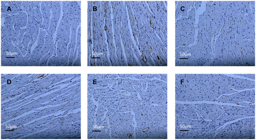 Figure 11 Effect of the PF on the expression of Caspase-9 in rats with myocardial infarction (immunohistochemistry, ×200).