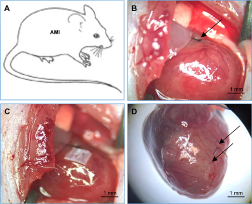 Figure S2 AMI mice coronary vessels was ligated inverse opal-loaded MSC transplantation in vivo.Notes: (A) Illustration for AMI mice; (B) ligation of the LAD artery (black arrow); (C) inverse opal-loaded MSCs (1×1 mm) transplanted into the heart of AMI mice; and (D) after the AMI mice were executed at 14–21 days, the interruption of blood flow and the surrounding infarcted myocardium can be seen (black arrow below).Abbreviations: AMI, acute myocardial infarction; LAD, left anterior descending; MSCs, mesenchymal stem cells.