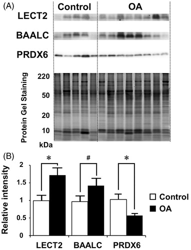 Figure 2. Western blot analysis of LECT2, BAALC and PRDX6. (A) We confirmed the protein expression levels of LECT2, BAALC and PRDX6 in OA and control. Protein gel was stained with SYPRO ruby. (B) Statistical analysis of western blot. Quantities are indicated relative to the average value of each protein level in controls. *p < 0.05, statistically significant differences between OA and control, as determined by Student’s t-test. Error bars indicate SEM. LECT2 (control, n = 5; OA, n = 16; p = 0.005), BAALC (control, n = 5; OA, n = 16; p = 0.051), PRDX6 (control, n = 5; OA, n = 16; p = 0.011). (#) p = 0.051.