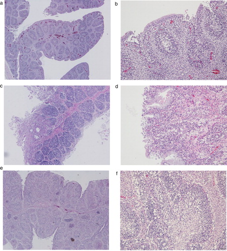 Figure 1. Representative histological lesions in bursa sections of chickens infected with Korean antigenic variant infectious bursal disease virus (avIBDV) strains isolated in this study. (a, b) Bursa of 19D38-infected chickens showed mild lymphoid reduction and congestion. (c, d) Bursa follicles of chickens infected with 19D69 were infiltrated with mononuclear inflammatory cells, and showed lymphoid depletion, loss of follicular epithelium, cysts, and connective tissue formation. (e, f) Severe bursal lesions caused by 19D75 including follicle destruction, massive lymphocyte depletion, and granulocyte degeneration. Tissues were subjected to H&E staining, and images were captured at 40× magnification (a, c, e) or 100× magnification (b, d, f).