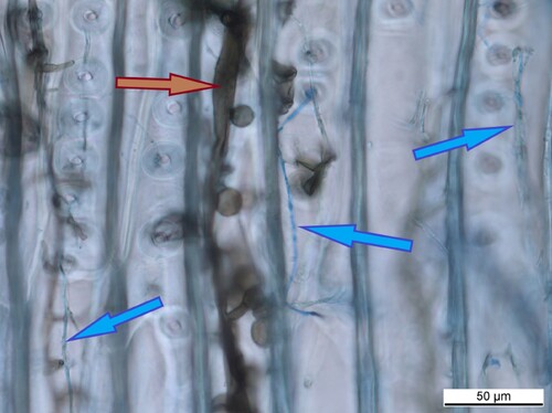 Figure 2. Hyphae of blue-staining fungi (orange arrow) and wood-degrading fungi (blue arrows) in tracheids of bark beetle infested spruce sapwood.