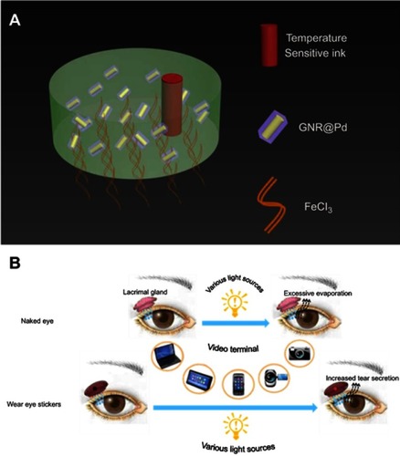 Figure 1 Ingredients and use of the eye patch. (A) The eye patch was composed of hydrogel, GNRs @ Pd, temperature sensitive ink, and FeCl3. (B) Schematic diagram of the function mechanism of the eye patch.Abbreviation: GNRs @ Pd, gold nanorods @ palladium.