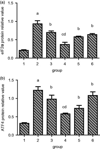 Figure 10. Quantitation of the effect of resveratrol on eIF2α and ATF4 protein expression in renal tissue of UUO rats. A, eIF2α. B, ATF4. Lane 1 represents the data as mean ± SEM, from sham treated group; lane 2 from model group; lane 3 from enalapril group; lane 4 from high-dose resveratrol group; lane 5 from middle-dose resveratrol group and lane 6 from low-dose resveratrol group. The differences are significant as “a” depicts p values of <0.01 versus the sham group, “b” represents p values of <0.05 versus model group, “c” represents p values of <0.01 versus model group while “d” represents p values of <0.05 versus enalapril group.