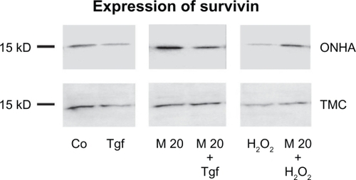 Figure 10 Expression of survivin. Western blot showing the protein expression of survivin in control (Co) and treated cell extracts: TGFβ-2 (Tgf), minocycline 20μM (M20), minocycline 20 μM and TGFβ-2 (M20+Tgf), 600 μM H2O2 (H2O2), and minocycline 20 μM and 600 μ M H2O2 (M20 + H2O2). Ten micrograms of protein were loaded per lane.