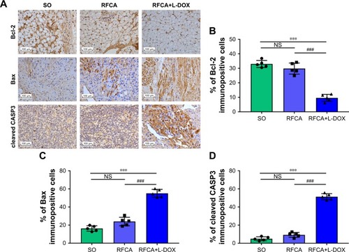 Figure 6 The expression of Bcl-2, Bax, and cleaved CASP3 in different groups (10×40).Notes: (A) Representative Bcl-2, Bax, and cleaved CASP3 protein levels in different treatment groups were measured via immunohistochemistry analysis. (B–D) Bcl-2, Bax, and cleaved CASP3 protein expression in each group. ***P<0.001 vs SO treatment; ###P<0.001 vs RFCA treatment. n=5 per group, data are presented as means ± SD.Abbreviations: L-DOX, liposomal doxorubicin; NS, not significant; RFCA, radiofrequency catheter ablation; SO, sham-operated.