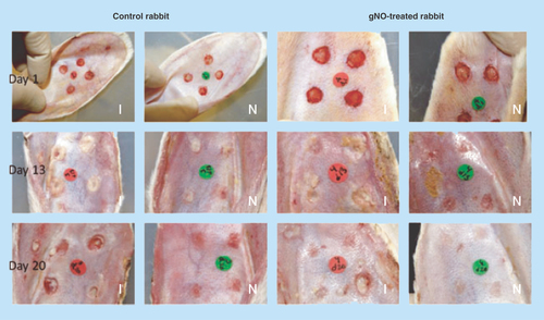 Figure 1.  Infected full-thickness dermal wounds on New Zealand white rabbit ears.Ischemic (I) and nonischemic (N) wounds were treated with NO probiotic patch or control patch at days 1, 13, and 20 postsurgery.gNO: Gaseous nitric oxide.Reproduced with permission from [Citation39]. © John Wiley & Sons, Inc. (2012).
