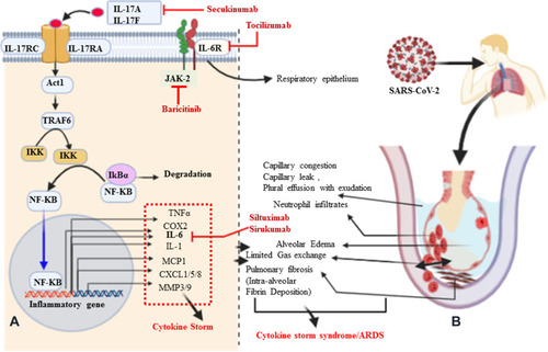 Figure 2 Signaling pathways of IL-17A, pathological effect, and potential drug targets. (A) Signaling transduction of IL-17A at type I epithelial cells of the alveoli of the lung. IL-17A and IL-17F are secreted predominantly by Th-17 cells; they are structurally very similar, bind the IL-17RA–IL-17RC receptor combination, and can form heterodimers together, signaling via the adaptor protein nuclear factor (NF)-κ activator (Act1). Many IL-17 target genes contain a promoter region that binds with NF-κB. IL-17 is not a potent inducer of inflammation by itself. Its strong effects during inflammation are derived from its ability to recruit immune cells via chemokine expression such as CXCL1, CXCL5, and MCP1, as well as from its synergistic action with other cytokines such as IL-6, IL-1, and TNFα. Thus, IL-17, acting in synergy with IL-6 and TNF, is a powerful inflammatory signal that results in the rapid recruitment and sustained presence of neutrophils and leads to a cytokine storm. (B) Schematic representation of IL-17A-mediated immunopathological effect of ARDS during SARS-CoV-2 infection. Pulmonary fibrosis is one of the pathological changes due to the activation of fibroblasts mediated by IL-6 and results in abnormal deposition of collagen. Moreover, the stimulation of fibroblasts can produce IL-8 and leads to the attraction of neutrophils to the site of injury. MMP3/9 (which causes tissue destruction) and PGE2 (increases capillary permeability) are also responsible for neutrophil infiltration, alveolar edema, and protein-positive (exudative) pleural effusion. Altogether, the proposed pathological mechanism suggests that IL-17 can mediate numerous immunopathological effects in CRS secondary to SARS-CoV-2 infection.