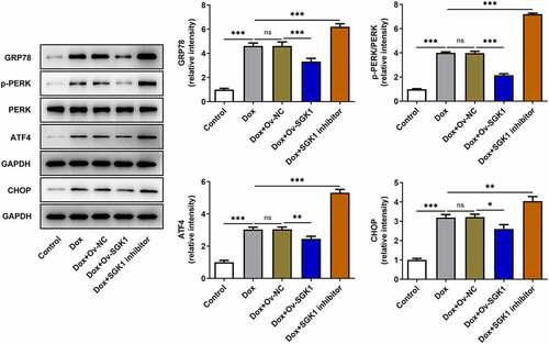 Figure 5. Upregulation of SGK1 relieved doxorubicin-induced ERS in H9c2 cells. Doxorubicin-treated H9c2 cells were transfected with Ov-SGK1 or treated with the specific SGK1 inhibitor EMD638683. Western blot assay for determination of GRP78, p-PERK, PERK, ATF4 and CHOP protein expressions in H9c2 cells. * p < 0.05, ** p < 0.01, *** p < 0.001.