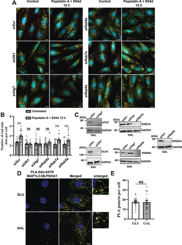 Figure 8. Effect of siRNA knockdowns on mitophagic flux and evaluation of LC3 involvement by proximity ligation assay (PLA). (A) Representative widefield images of mCherry-EGFP- SYNJ2BP-TM H9c2 cells analyzed 48 h after transfection with scrambled siRNA (siScr) or siRNA against Ulk1, Atg7, Rab9a, Rab7a or Rab5a respectively. (B) Quantification of the effect of 48 h siRNA knockdowns by assessment of number of red-only dots per cell in cells containing red-only dots in control conditions against a 12 h PepA and E64d treatment. The data is presented as mean ± SEM from 3 independent experiments, with more than 100 cells per condition (total number analyzed per experiment was over 1200 cells). (C) Western blots showing the expression levels of the siRNA targeted proteins in control and siRNA treated cells for verification of successful knockdown. (D) Representative confocal images of detected PLA puncta (white) using anti-MAP1LC3B and anti-PDHA1 antibody during normal (GLU) and galactose (GAL) adapted conditions. The enlarged boxes display the PLA puncta on the mitochondria network and small mitochondrial fragments but their absence on red-only dots. (E) Quantification of the number of PLA puncta per cell in 10 images (with more than 50 cells in total) per condition from two independent experiments. The individual datapoints are per frame cell averages. * p < 0.05, ** p < 0.01, *** p < 0.001 and **** p < 0.0001. Scale bar: 10 μm.