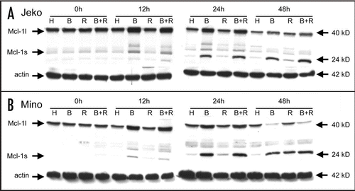 Figure 5 Mcl-1 cleavage induced by bortezomib. Jeko (A) and Mino (B) cell lines were cultured in the presence of 10 nM bortezomib (continuous exposure) and/or rituximab (1 µg/ml) plus cross-linker, harvested at 0, 12, 24 and 48 hours and immunoblotted for Mcl-1 (Mcl-1l, pro-form; Mcl-1s, cleaved form; H, herceptin; B, bortezomib; R, rituximab; B + R, bortezomib + rituximab).