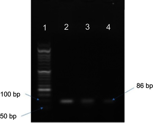 Figure 2 Electrophoresis of PCR products on 1% agarose gel. Amplified product is 86 bp. 1: Size marker (50 bp); 2, 3: samples, 4: positive control.