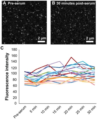 Figure 2 The addition of serum to nanoparticles in the absence of cells does not affect nanoparticle fluorescence. Representative images of nanoparticles in (A) serum-free media and (B) after 30 minutes incubation with serum. (C) Total fluorescence intensity of nanoparticle spots in a single frame over 30 minutes.