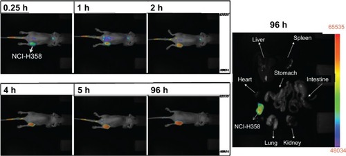 Figure 6 NCI-H-358 tumor accumulation of IR-780-loaded CSMA-g-PCL micelle in female Balb/c mice (6–8 weeks old) according to time and isolated tissues at 96 h after instillation using a NIR non-invasive optical imaging technique (n = 3 mice).Abbreviation: CSMA-g-PCL, Poly(ε-caprolactone)-g-methacrylated chondroitin sulfate.