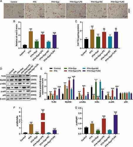 Figure 4. Effects of LPS stimulation or upregulating TLR4 signaling pathway on Gyp’s inhibition of FFA-induced simple steatosis in THLE-2 cells. (a and b) Oil Red O staining was used to detect lipid droplet deposition. (c) Kit used to detect triglyceride (TG) content in cells. (D, E, F, and G) The expression levels of MyD88, p-IκBα, κBα, and p-p65 and p65 were detected by Western blotting. n = 3, +P < 0.05, ++P < 0.01, +++P < 0.001, vs. 0; *P < 0.05, **P < 0.01, ***P < 0.001, vs. Control; ^P < 0.05, ^^P < 0.01, ^^^P < 0.001, vs. FFA; #P < 0.05, ##P < 0.01, ###P < 0.001, vs. Gyp; &P < 0.05, &&P < 0.01, &&&P < 0.001, vs. FFA+Gyp+NC